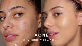 HOW TO: COVER ACNE WITH MAKEUP (BASE ROUTINE)