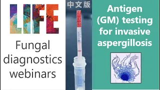 Aspergillus antigen (galactomannan) - fungal diagnostics webinar (with Q&A) invasive aspergillosis