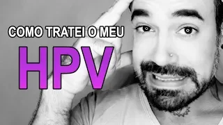 HIV/AIDS - COMO TRATEI O MEU HPV | Léo Cezimbra