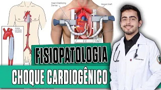 Choque Cardiogênico [PARTE 2/4] │ Fisiopatologia