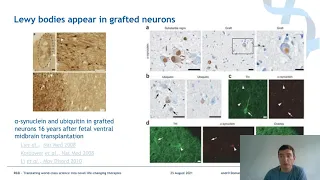 Alpha-synuclein Aggregation in Parkinson's Disease - Is it Relevant and How can we Model it?