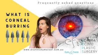 FAQ - What is corneal burring with Dr Anthony Maloof, Sydney