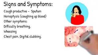 Bronchiectasis- Symptoms, Causes, Pathogenesis, Treatment