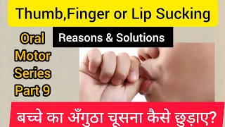 Thumb/finger or lip sucking- reasons & solutions/बच्चे का अँगुठा चूसना कैसे छुड़ाए?oral motor part 9