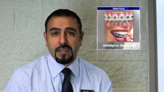 Invisalign Vs Damon Smiles | Friday Focus | E&S Orthodontics