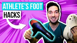 How to get rid of athlete's foot between toes removal and treatment