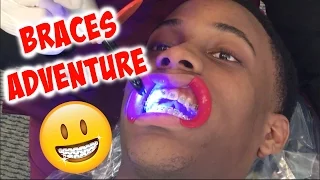 Braces Adventure + Braces in the Air Force? | DeeByDefault