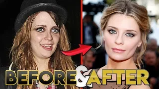 Mischa Barton | Before and After Transformations | The Hills: New Beginnings