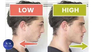 How Testosterone Affects Your Facial Attractiveness - (blackpill analysis)