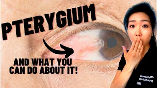 What Is A Pterygium? | Causes, Symptoms, And Treatments For Surfer's Eye!