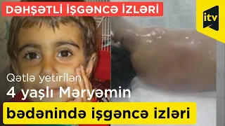 Qətlə yetirilən 4 yaşlı Məryəmin bədənində DƏHŞƏTLİ İŞGƏNCƏ İZLƏRİ- FOTOLAR