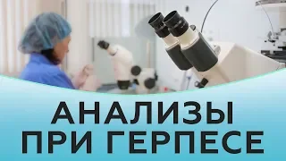 Какие анализы сдают при герпесе