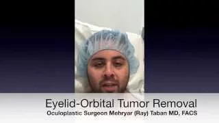 Eyelid-Orbital Tumor Removal Surgery Los Angeles, Beverly Hills