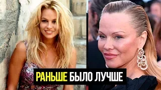 ПАМЕЛА АНДЕРСОН ЧТО С НЕЙ СТАЛО?