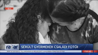 Radar - Sérült gyermekek családi fotói (2022-02-21) - HÍR TV