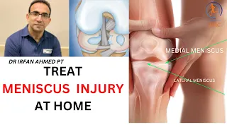 TOP 6 EXERCISES FOR MEDIAL OR LATERAL MENISCUS INJURY AT HOME | COMPLETE TREATMENT | In Urdu/Hindi