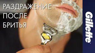 Как Избежать Раздражения После Бритья | Gillette ProShield