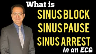 Sinus Arrhythmia, Sinus Block, Sinus Pause, Sinus Arrest ECG, Causes, Treatment, ECG Lectures USMLE