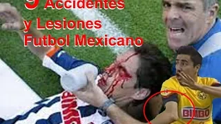 9 Lesiones y Accidentes en el Futbol Mexicano