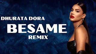 Dhurata Dora - Besame (RUZ D REMIX)