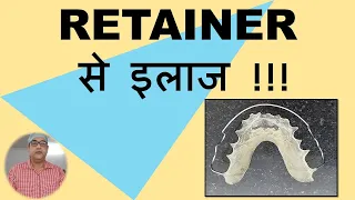 RETAINER TYPE BRACES, REMOVABLE BRACES