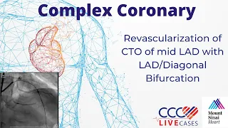 Revascularization of CTO of mid LAD with LAD/Diagonal Bifurcation - July 20, 2010 Webcast Video