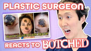 DIY Cancer Treatment Destroys Nose! Plastic Surgeon Reacts to BOTCHED!