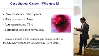 Treatments for Barrett's Oesophagus and Oesophageal Cancer, and Other GI Problems