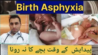 Birth Asphyxia | Asphyxia Neonatorum | paida hony ke bad bachay ka na rona ya foat ho jana