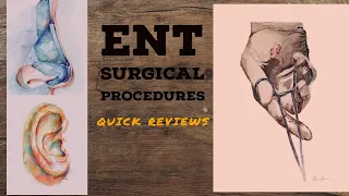 ENT SURGICAL PROCEDURES lecture 2 MYRINGOPLASTY, Tympanoplasty Underlay Overlay techniques made easy
