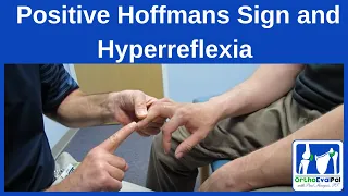 Positive Hoffmans Sign and Hyperreflexia