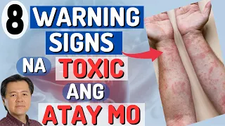 8 Warning Signs na Toxic ang Atay Mo (Liver Toxicity). - By Doc Willie Ong