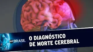 Neurocirurgião explica rígido protocolo para diagnóstico de morte cerebral | SBT Brasil (23/11/19)