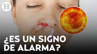 ¿Es peligroso? Esta es la razón por la que te sangra la nariz cuando hace mucho calor