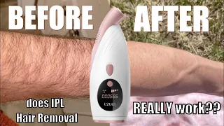 IPL Hair Removal (My 8 Week Experiment & Results)