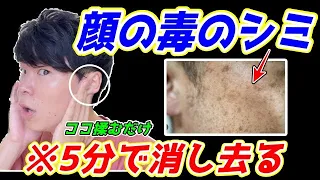 【耳を揉むだけ！顔のシミ消えて61歳⇨51歳✨】顔中のリンパを流して顔のシミ、顔のたるみ、ほうれい線、口元のたるみ解消！ストレートネックも解消できて全身の代謝も上がり痩せるエクササイズ！