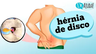 O que é a HÉRNIA DE DISCO? Entenda como ocorre e seus sintomas!