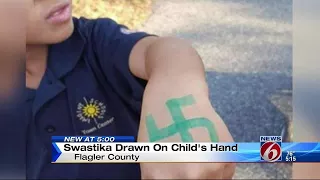 Boy comes home from school with swastika on arm