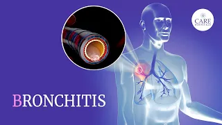 Know About Bronchitis: Types, Causes, Symptoms, Treatment And Prevention | CARE Hospitals