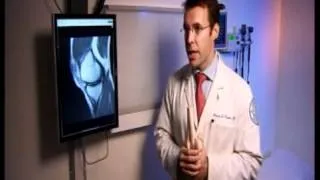 Meniscus Injury Discussion