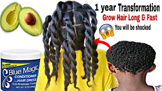 Use this instead of Cloves! How I grew my hair with Avocado n Blue magic hair grease #hairgrowth