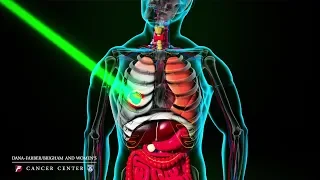 Innovative MRI-Guided Radiation Therapy: Advancing Precision in Cancer Treatment | Brigham Health