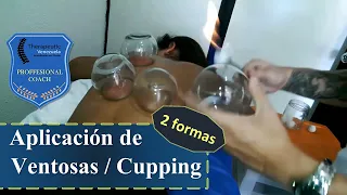 Aplicación de Ventosas / Cupping. Efectos y Usos.