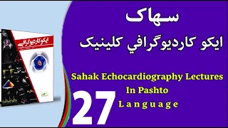 Sahak Echocardiography Lectures 27 Left atrial volume and LV mass