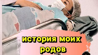 История моих родов #роды#двойняшки#follow