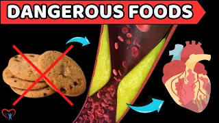 Stay Away! 5 Dangerous Ultra-Processed Foods for Heart Health | Vitality Solutions