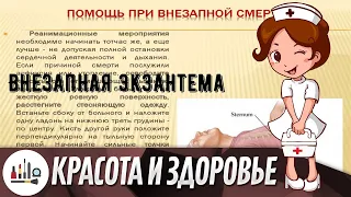 Внезапная экзантема