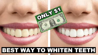 How to Whiten Teeth at Home