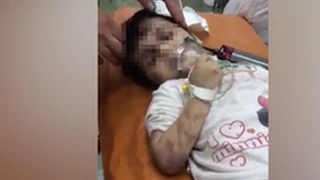 СМИ: Кадыров вступился за избитую мачехой девочку