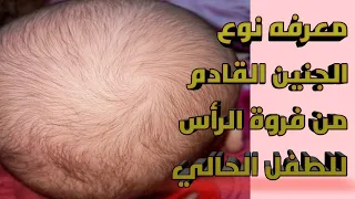 معرفه نوع الجنين القادم من رأس الطفل آليا قبله  وراها ولد ولا بنت بطريقة جدتي مضمون,💯